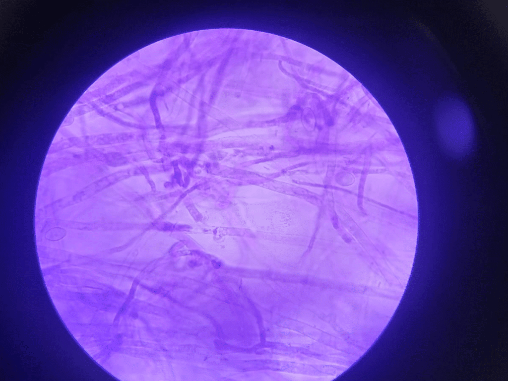 microbiologia-ensayo4-santoto-tunja